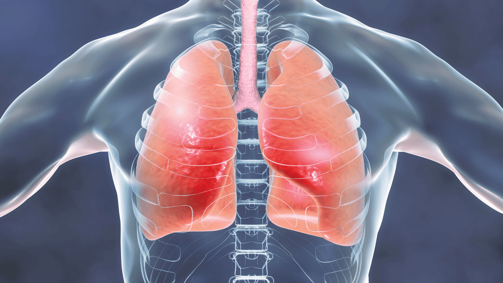 image showing infected lungs TB