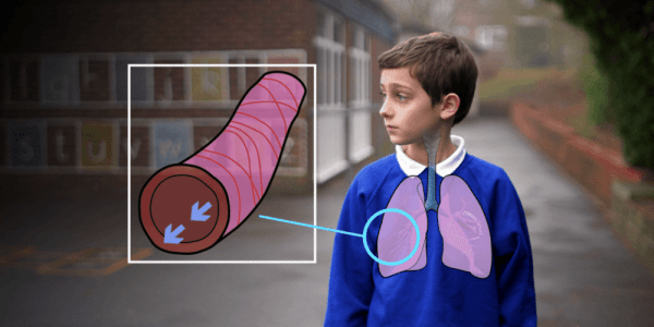 image showing asthma training for schools boy lungs