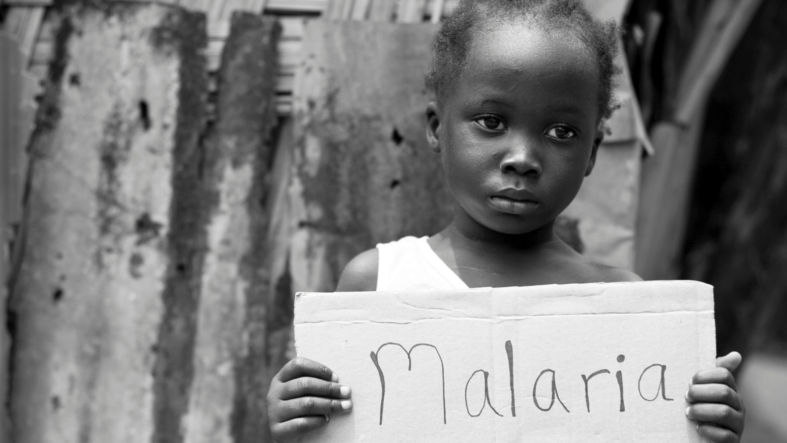 image showing Malaria child