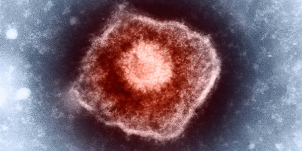 Image of Varicella Zoster Virus