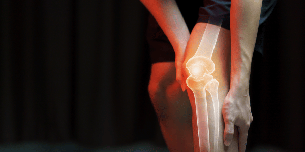 Assessment & Immediate Management of an Acute Knee Injury – (Bournemouth 2023)