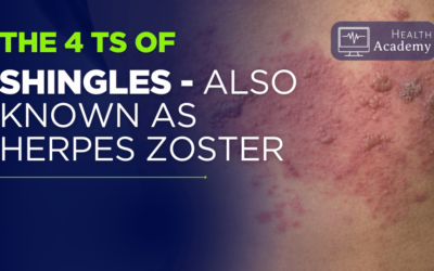 Understanding the 4T’s of Shingles