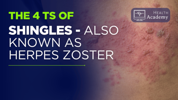 Understanding the 4T's of Shingles - Health Academy