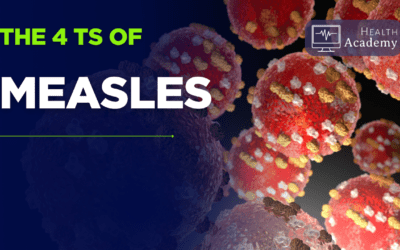 Understanding the 4T’s of Measles