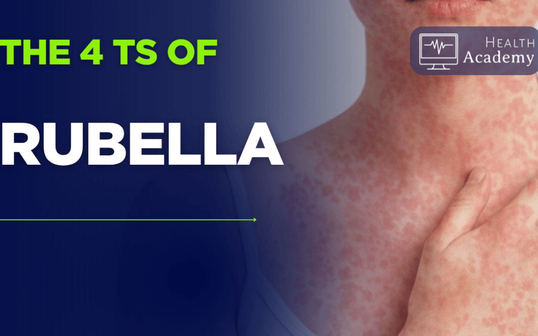 Understanding the 4T’s of Rubella
