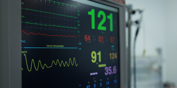 image showing cardiac monitor showing Atrial fibrillation for Atrial Fibrillation Update in Primary Care